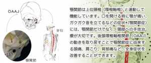 顎関節症に由来する頭痛、肩こり、背部痛などの改善